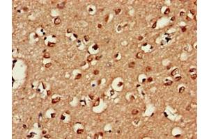 Immunohistochemistry (IHC) image for anti-Ubiquitin Specific Peptidase 18 (USP18) (AA 18-118), (C-Term) antibody (ABIN7174583)