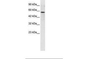 Image no. 1 for anti-RUN and FYVE Domain Containing 3 (RUFY3) (C-Term) antibody (ABIN6735951) (RUFY3 Antikörper  (C-Term))