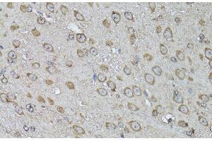 Immunohistochemistry of paraffin-embedded Mouse brain using Snail Polyclonal Antibody at dilution of 1:100 (40x lens). (SNAIL Antikörper)