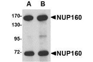 Image no. 1 for anti-Nucleoporin 160kDa (NUP160) (C-Term) antibody (ABIN1103361) (NUP160 Antikörper  (C-Term))
