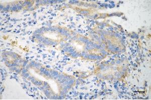 anti-Tripartite Motif Containing 47 (TRIM47) antibody