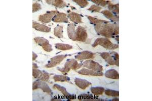 ACTN3 Antibody (Center) immunohistochemistry analysis in formalin fixed and paraffin embedded human skeletal muscle followed by peroxidase conjugation of the secondary antibody and DAB staining. (ACTN3 Antikörper  (Middle Region))