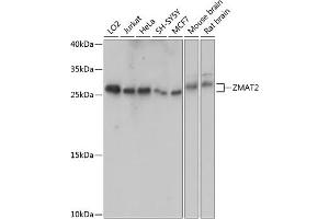 Western blot analysis of extracts of various cell lines, using ZM antibody (ABIN7271560) at 1:1000 dilution.