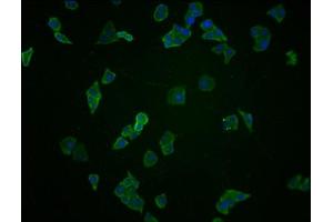 Immunofluorescence staining of Hela cells with ABIN7145214 at 1:100, counter-stained with DAPI. (BAG3 Antikörper  (AA 220-420))