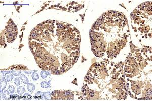 Immunohistochemical analysis of paraffin-embedded mouse testis tissue. (MICU1 Antikörper)