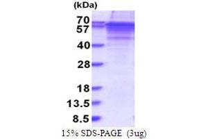 Vitronectin Protein (VTN) (AA 20-478) (His tag)