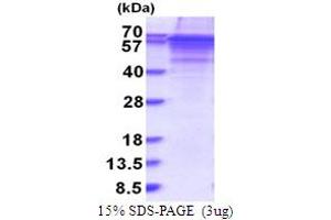 SDS-PAGE (SDS) image for Vitronectin (VTN) (AA 20-478) protein (His tag) (ABIN5853784) (Vitronectin Protein (VTN) (AA 20-478) (His tag))