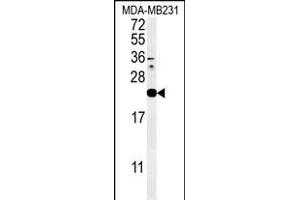 Western blot analysis of IL1F6 Antibody (Center) (ABIN651427 and ABIN2840233) in MDA-M cell line lysates (35 μg/lane). (IL36A/IL1F6 Antikörper  (AA 35-61))