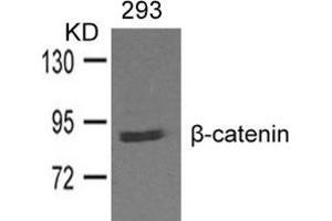 Western blot analysis of extracts from 293 cells and using β-catenin. (CTNNB1 Antikörper  (AA 327-331))