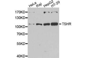 TSH receptor Antikörper  (AA 21-253)