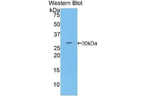 Detection of Recombinant TOR1B, Human using Polyclonal Antibody to Torsin 1B (TOR1B)