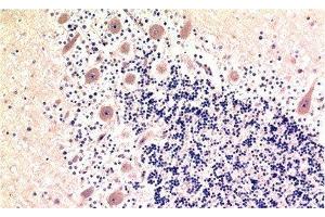 Immunohistochemistry of paraffin-embedded Human brain tissue using MAP1LC3B Monoclonal Antibody at dilution of 1:200. (LC3B Antikörper)