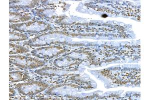 ABIN6260850 and ABIN6273034 at 1/100 staining Rat colon tissue by IHC-P.