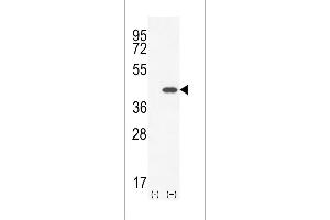 Western blot analysis of CLEC11A using rabbit polyclonal CLEC11A Antibody using 293 cell lysates (2 ug/lane) either nontransfected (Lane 1) or transiently transfected (Lane 2) with the CLEC11A gene.