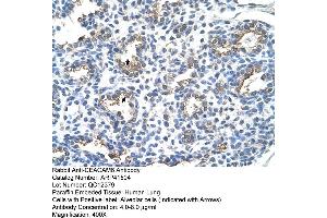 Rabbit Anti-CEACAM6 Antibody  Paraffin Embedded Tissue: Human Lung Cellular Data: Alveolar cells Antibody Concentration: 4.