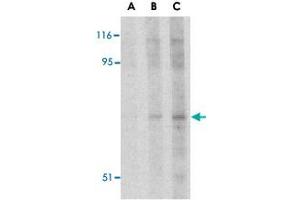 Western blot analysis of RPS6KA1 in Jurkat cell lysate with RPS6KA1 polyclonal antibody  at (A) 2. (RPS6KA1 Antikörper  (N-Term))