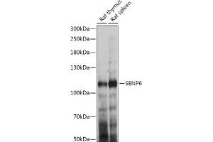 Western blot analysis of extracts of various cell lines, using SENP6 antibody (ABIN7270635) at 1:1000 dilution. (SENP6 Antikörper  (AA 811-1112))