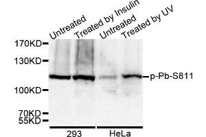 Western Blotting (WB) image for anti-Retinoblastoma 1 (RB1) (pSer811) antibody (ABIN3023610) (Retinoblastoma 1 Antikörper  (pSer811))