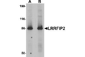 Western blot analysis of LRRFIP2 in rat colon tissue lysate with LRRFIP2 antibody at (A) 0.