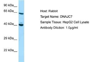 Western Blotting (WB) image for anti-DnaJ (Hsp40) Homolog, Subfamily C, Member 7 (DNAJC7) (C-Term) antibody (ABIN970539) (DNAJC7 Antikörper  (C-Term))