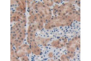 Used in DAB staining on fromalin fixed paraffin- embedded Kidney tissue (IL12RB1 Antikörper  (AA 197-348))