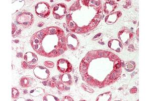 Human Kidney: Formalin-Fixed, Paraffin-Embedded (FFPE). (TRIB1 Antikörper  (C-Term))