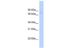 EFHC1 antibody used at 0. (EFHC1 Antikörper  (N-Term))