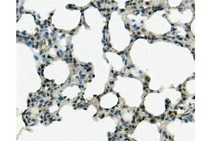 IHC analysis of REC8 using anti-REC8 antibody (ABIN7599473). (REC8 Antikörper  (AA 1-547))
