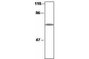 Western blot analysis of Arabidopsis thylakoid proteins with anti-CF1 beta (CF1 beta (AtpB) Antikörper)
