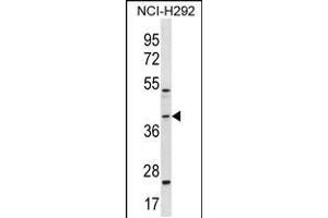 Western blot analysis in NCI-H292 cell line lysates (35ug/lane). (GIPC2 Antikörper  (C-Term))