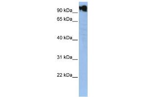 WB Suggested Anti-ZFY Antibody Titration:  0. (ZFY Antikörper  (N-Term))