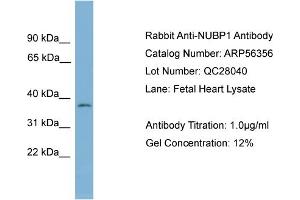 WB Suggested Anti-NUBP1  Antibody Titration: 0. (NUBP1 Antikörper  (Middle Region))