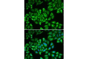 Immunofluorescence analysis of A549 cells using FTL antibody (ABIN5970889). (FTL Antikörper)