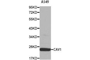 Western blot analysis of extracts of A549 cell using CAV1 antibody. (Caveolin-1 Antikörper  (AA 1-100))