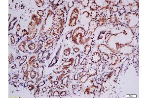 Formalin-fixed and paraffin embedded human kidney labeled with Rabbit Anti-RSK2(Tyr529) Polyclonal Antibody, Unconjugated (ABIN745283) at 1:200 followed by conjugation to the secondary antibody and DAB staining (RPS6KA3 Antikörper  (pTyr529))