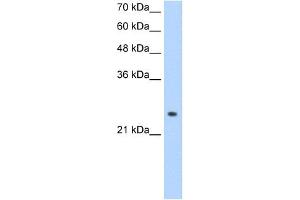 ADH6 antibody used at 1. (ADH6 Antikörper)