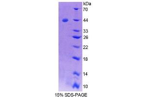 SDS-PAGE analysis of Human SYCN Protein.