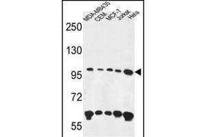 ANKFY1 Antibody (C-term) (ABIN650902 and ABIN2839988) western blot analysis in MDA-M,CEM,MCF-7,Jurkat,Hela cell line lysates (35 μg/lane). (ANKFY1 Antikörper  (C-Term))