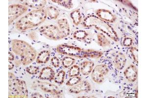 Formalin-fixed and paraffin embedded human kidney labeled with Rabbit Anti RISC/Serine carboxypeptidase 1 Polyclonal Antibody, Unconjugated (ABIN872910) at 1:200 followed by conjugation to the secondary antibody and DAB staining (SCPEP1 Antikörper  (AA 121-320))