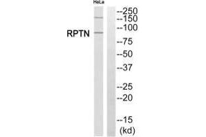 Western blot analysis of extracts from HeLa cells, using RPTN antibody. (Repetin Antikörper  (C-Term))