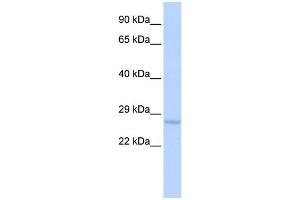 WB Suggested Anti-USE1 Antibody Titration:  0.