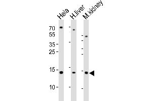 Western blot analysis of lysates from Hela cell line, human liver and mouse kidney tissue lysate(from left to right), using CDA Antibody (Center) (ABIN389394 and ABIN2839486). (CDA Antikörper  (AA 51-83))