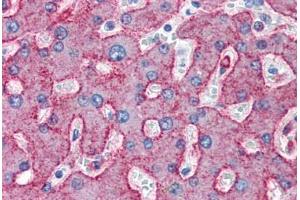 Human Liver (formalin-fixed, paraffin-embedded) stained with LRP1 antibody ABIN337392 at 10 ug/ml followed by biotinylated anti-mouse IgG secondary antibody ABIN481714, alkaline phosphatase-streptavidin and chromogen. (LRP1 Antikörper)