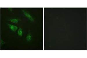 Immunofluorescence analysis of HeLa cells, using NFAT3 (Ab-676) Antibody. (NFATC4 Antikörper  (AA 642-691))