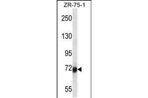 Western blot analysis in ZR-75-1 cell line lysates (35ug/lane). (SP100 Antikörper  (N-Term))