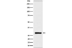 Western blot analysis of BRMS1 expression in HeLa cell lysate. (Rekombinanter BRMS1 Antikörper)