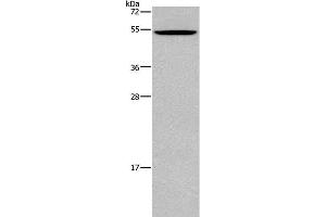 Western Blot analysis of Mouse testis tissue using CATSPER3 Polyclonal Antibody at dilution of 1:350