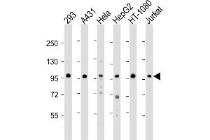 All lanes : Anti-DDX21 Antibody (N-term) at 1:2000 dilution Lane 1: 293 whole cell lysate Lane 2: A431 whole cell lysate Lane 3: Hela whole cell lysate Lane 4: HepG2 whole cell lysate Lane 5: HT-1080 whole cell lysate Lane 6: Jurkat whole cell lysate Lysates/proteins at 20 μg per lane.