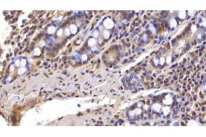 Detection of FBLN3 in Human Small intestine Tissue using Monoclonal Antibody to Fibulin 3 (FBLN3) (FBLN3 Antikörper  (AA 26-213))