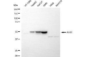 Western blotting analysis using ALG2 antibody (ABIN7797663).